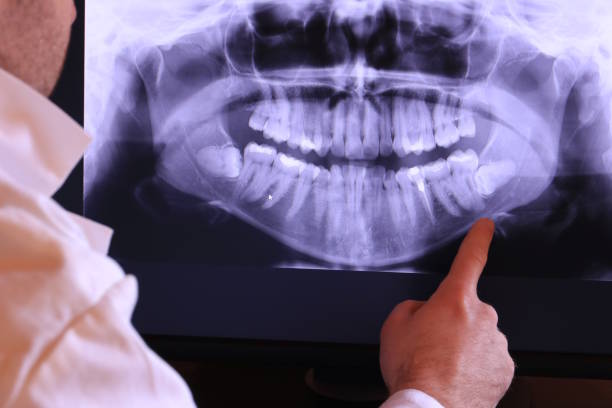 Best Emergency Tooth Extraction in Gifford, FL