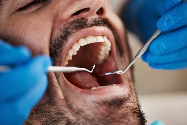 Best Emergency Dental Care for Broken or Chipped Teeth in Gifford, FL